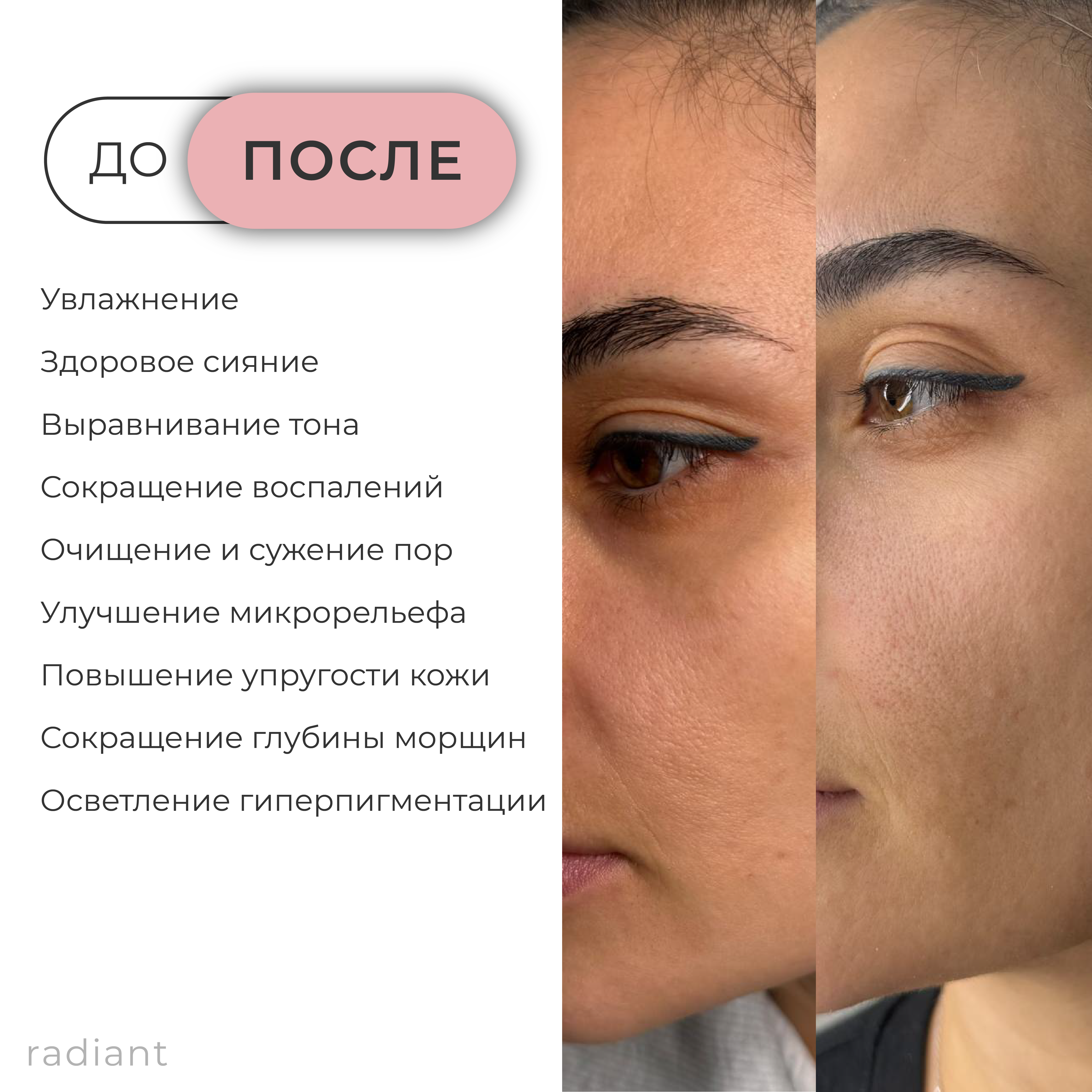 AGT P Radiant 50 мл. Срединный комбинированный пилинг